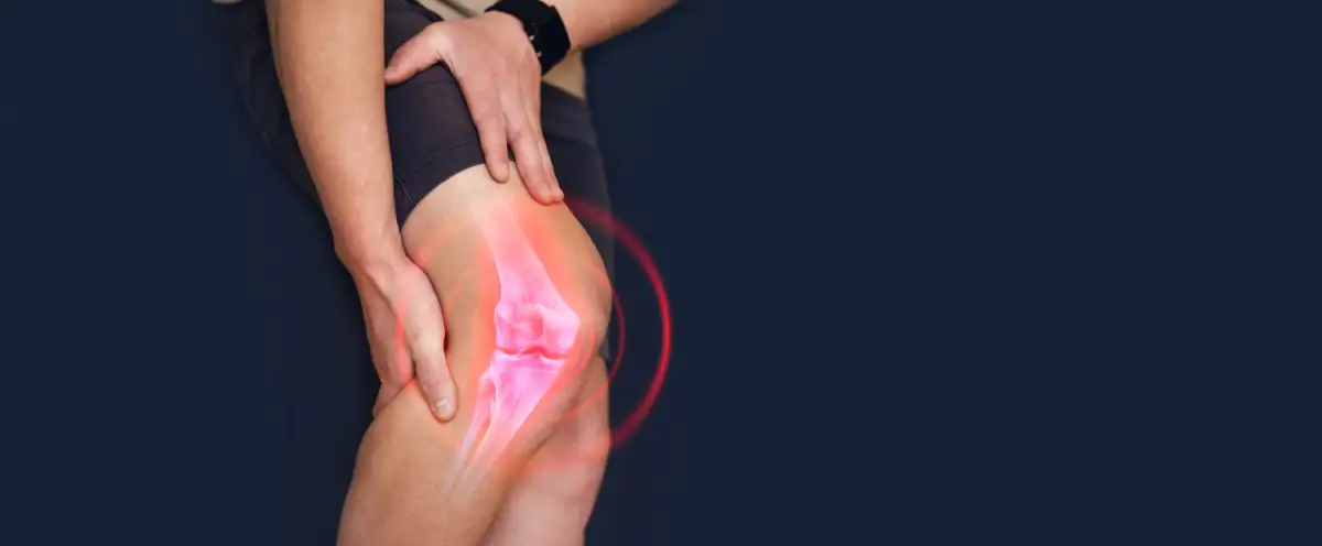 მუხლის ართროზი - დაზიანებული სახსარი, რომელიც საჭიროებს ყურადღებას